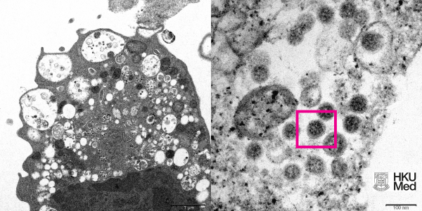 Ученым удалось сфотографировать штамм коронавируса Омикрон фото - 