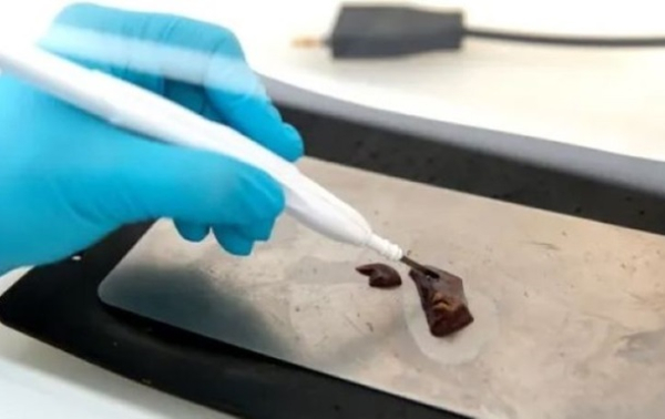 Создано устройство, которое вмиг обнаруживает рак шейки матки