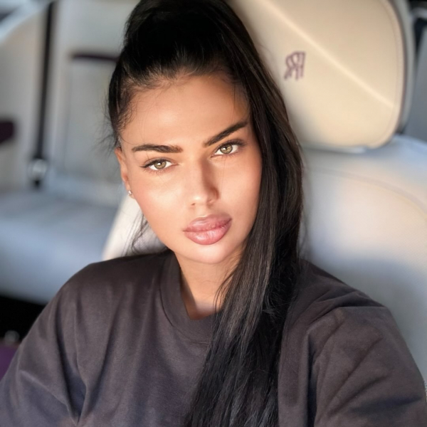 Прокуратура відкрила справу проти косметологині, яку звинувачують у смерті пацієнтки в Молдові 